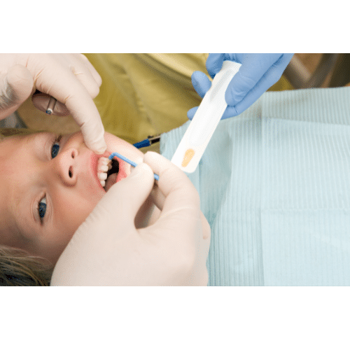 Fluoride Treatment in Peabody - Contemporary Dentistry and Implantology