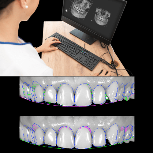 Digital Dentistry in Peabody - Contemporary Dentistry and Implantology