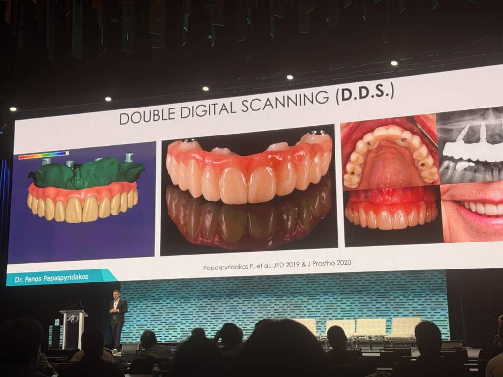Digital Full Arch Hybrid Restorations in Peabody - Dental Implants in Peabody, MA