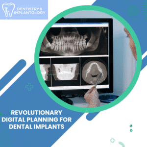 Digital Planning for Dental Implants in Peabody, MA - Contemporary Dentistry and Implantology - Panos Papaspyridakos